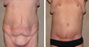 Before & After Photos